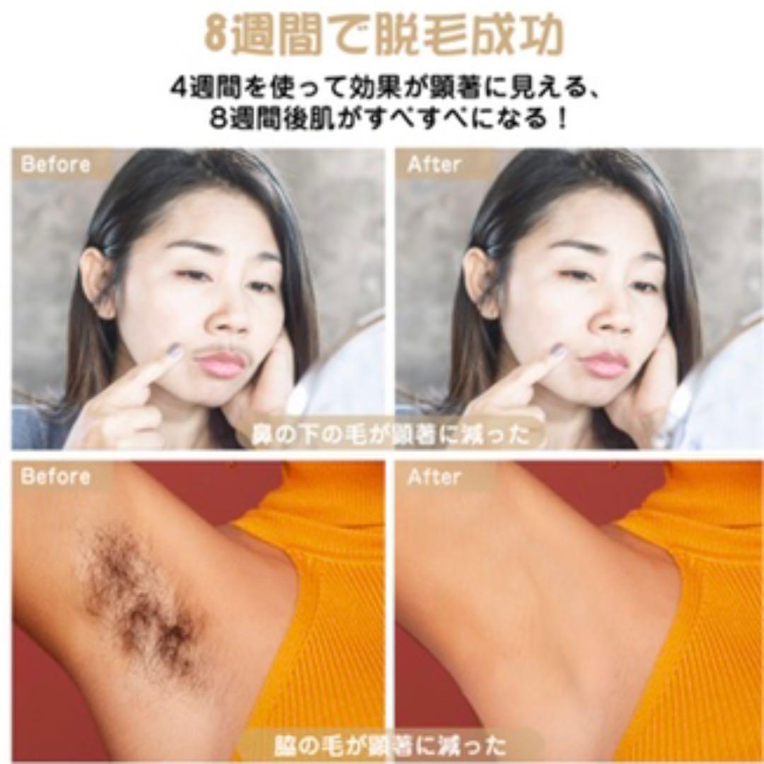 【即購入可】光美容器 ムダ毛ケア家庭用 全身脱毛 男女兼用